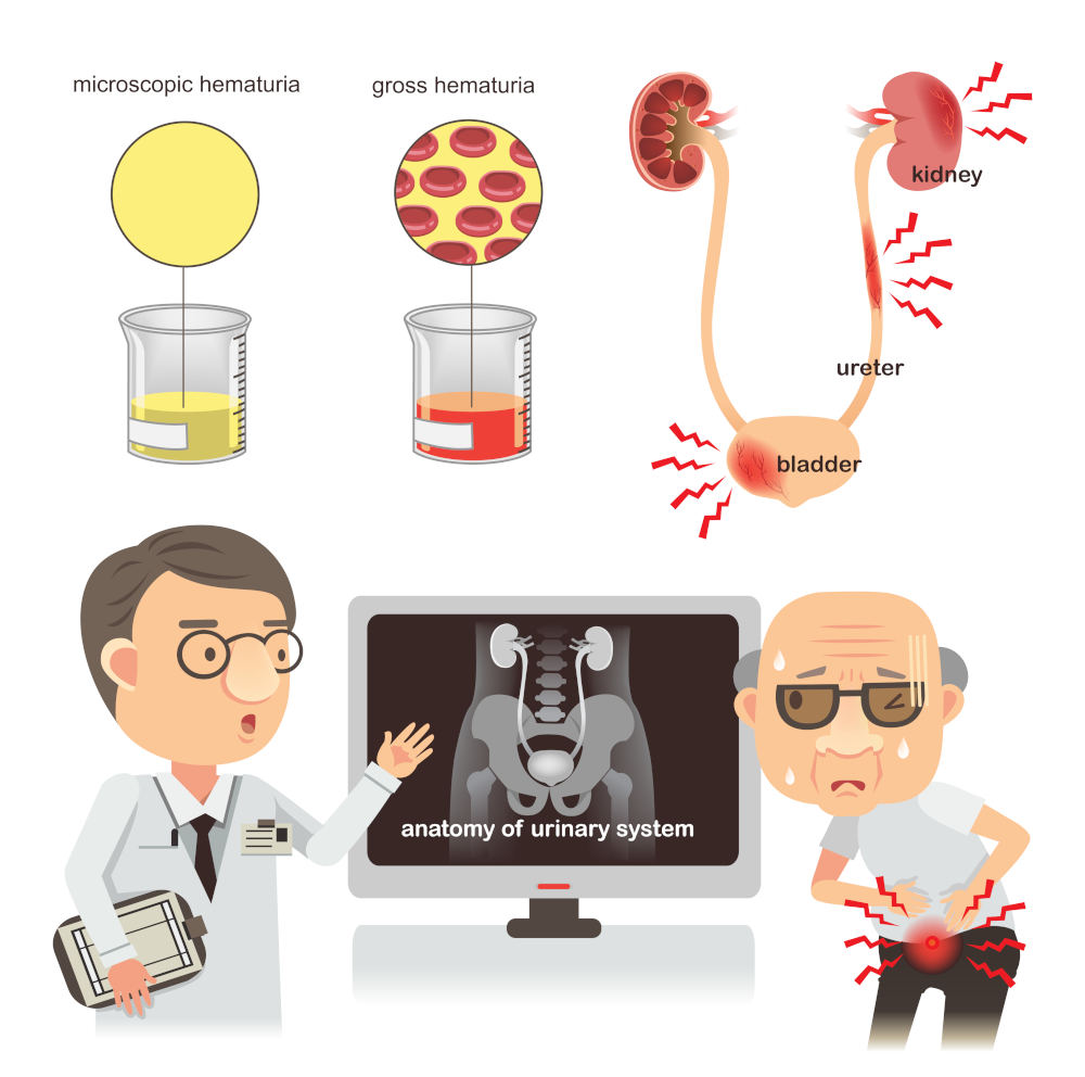 Sri Chakra Hospital Services Nephrology