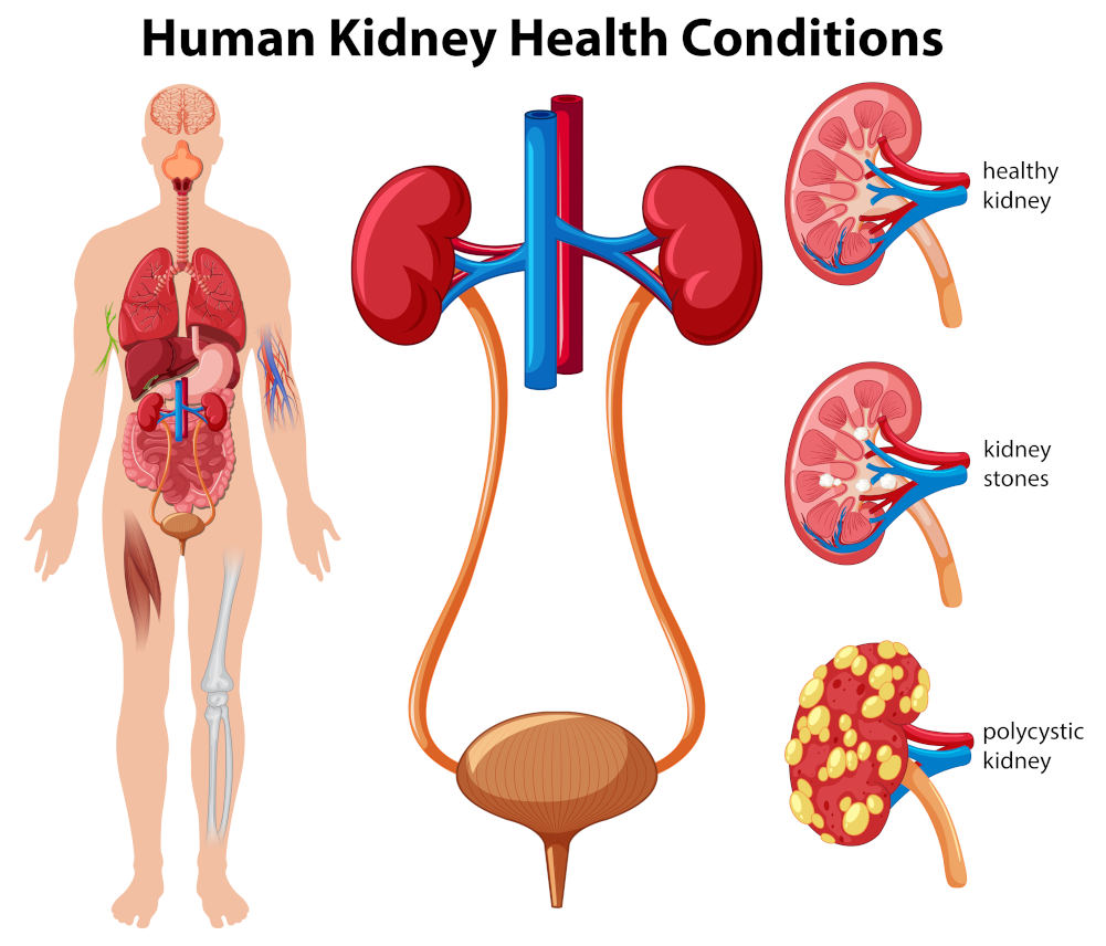 Sri Chakra Hospital Urology Department